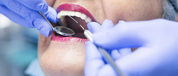 Best Emergency Tooth Extraction in Passapatanzy, VA